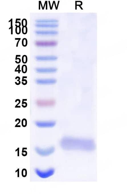 SDS-PAGE
